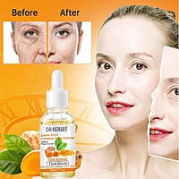 TUMERIC DARK SPOT CORRECTION FACE SERUM - 30ML TUMERIC DARK SPOT CORRECTION FACE SERUM - 30ML