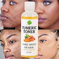TUMERIC TONER DARK SPOT ERASER - 100ML TUMERIC TONER DARK SPOT ERASER - 100ML